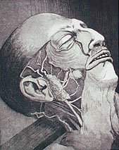 Cadaver II